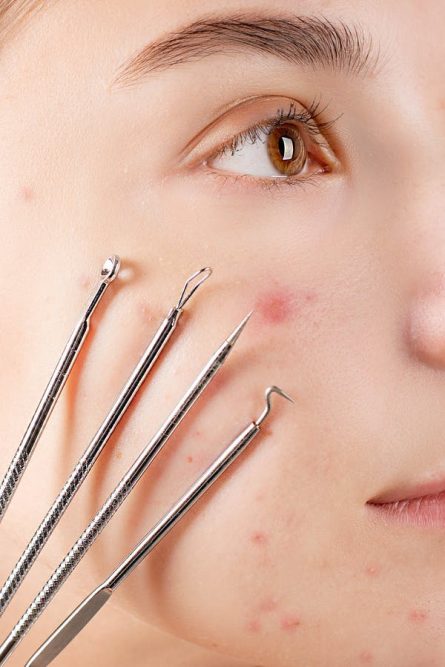 CONSIGLI SU ACNE E SKINCARE: L’INTERVISTA AL DERMATOLOGO